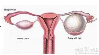 卵巢癌术后可以吃方瓜吗,方瓜的适宜摄入探讨  第3张